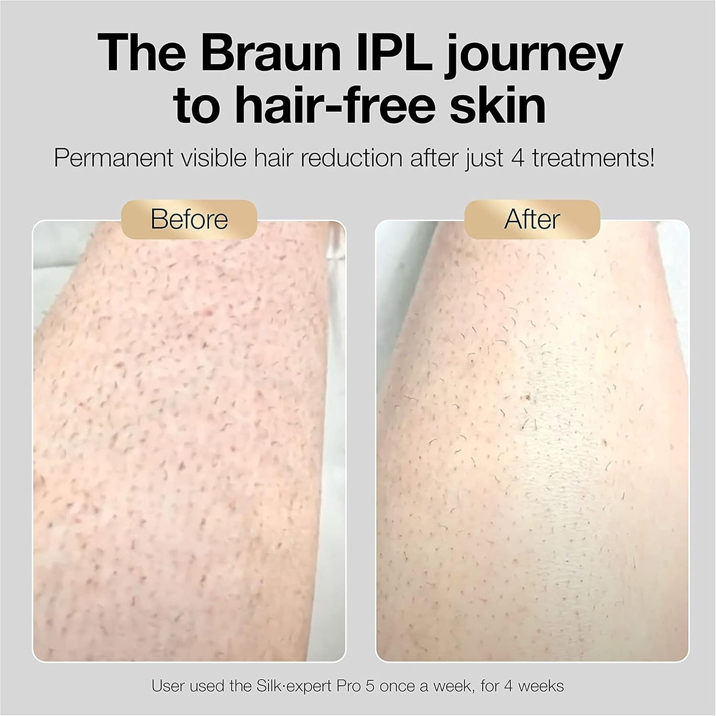 Braun Silk Expert Pro 5 PL5157 IPL Hair Removal Device for Women & Men - New Condition